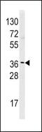 Histamine N-Methyltransferase antibody, PA5-11499, Invitrogen Antibodies, Western Blot image 