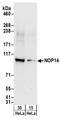 NOP14 Nucleolar Protein antibody, A303-868A, Bethyl Labs, Western Blot image 