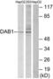 Disabled homolog 1 antibody, LS-B9241, Lifespan Biosciences, Western Blot image 