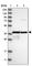 Mitochondrial RRNA Methyltransferase 1 antibody, HPA021598, Atlas Antibodies, Western Blot image 