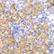 HPD antibody, LS-C334758, Lifespan Biosciences, Immunohistochemistry paraffin image 