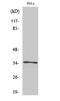 Olfactory Receptor Family 52 Subfamily E Member 6 antibody, A17559, Boster Biological Technology, Western Blot image 