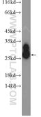 Joining Chain Of Multimeric IgA And IgM antibody, 13688-1-AP, Proteintech Group, Western Blot image 