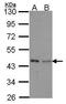 Isovaleryl-CoA Dehydrogenase antibody, GTX114502, GeneTex, Western Blot image 