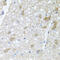 43 kDa receptor-associated protein of the synapse antibody, 22-432, ProSci, Immunohistochemistry frozen image 