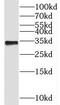 SAGA-associated factor 29 homolog antibody, FNab07805, FineTest, Western Blot image 