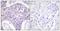 Forkhead Box O1 antibody, TA326191, Origene, Immunohistochemistry paraffin image 