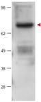 Protein kinase C beta type antibody, AP09394PU-N, Origene, Western Blot image 