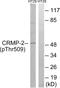 Dihydropyrimidinase Like 2 antibody, GTX55355, GeneTex, Western Blot image 