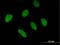 Zinc Finger And BTB Domain Containing 46 antibody, H00140685-B01P, Novus Biologicals, Immunocytochemistry image 