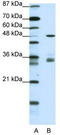 PHD Finger Protein 1 antibody, TA331748, Origene, Western Blot image 