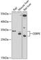 CCAAT/enhancer-binding protein epsilon antibody, 15-296, ProSci, Western Blot image 