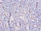 Hepatitis A virus cellular receptor 1 homolog antibody, A52368-100, Epigentek, Immunohistochemistry paraffin image 