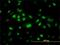 RNF12 antibody, H00051132-M01, Novus Biologicals, Immunocytochemistry image 