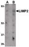 Limpii antibody, PA5-20544, Invitrogen Antibodies, Western Blot image 