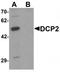 Decapping MRNA 2 antibody, TA320127, Origene, Western Blot image 