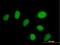 Zinc Finger Protein 792 antibody, H00126375-B01P, Novus Biologicals, Immunocytochemistry image 