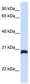 Peroxisomal Biogenesis Factor 11 Alpha antibody, TA339384, Origene, Western Blot image 