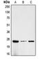 Human Chorionic gonadotrophin antibody, MBS821767, MyBioSource, Western Blot image 
