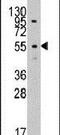 Leucine Aminopeptidase 3 antibody, PA5-14180, Invitrogen Antibodies, Western Blot image 