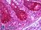 Solute carrier family 12 member 2 antibody, LS-B6385, Lifespan Biosciences, Immunohistochemistry frozen image 