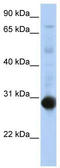 Nuclear Receptor Subfamily 0 Group B Member 2 antibody, TA338004, Origene, Western Blot image 