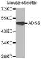 Adenylosuccinate synthetase isozyme 2 antibody, LS-C332731, Lifespan Biosciences, Western Blot image 