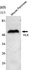 H2.0-like homeobox protein antibody, A06177-2, Boster Biological Technology, Western Blot image 