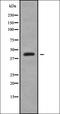 Pipecolic Acid And Sarcosine Oxidase antibody, orb378376, Biorbyt, Western Blot image 