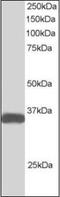 STE20 Related Adaptor Beta antibody, orb88429, Biorbyt, Western Blot image 