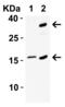 Cyclin-dependent kinase inhibitor 2A, isoforms 1/2/3 antibody, 4211, ProSci, Immunohistochemistry paraffin image 