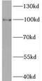 BRCA1 Interacting Protein C-Terminal Helicase 1 antibody, FNab00956, FineTest, Western Blot image 