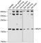 Ribosomal Protein Lateral Stalk Subunit P1 antibody, 22-439, ProSci, Western Blot image 