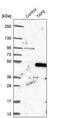 TATA-Box Binding Protein Associated Factor 8 antibody, PA5-56837, Invitrogen Antibodies, Western Blot image 