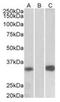 KChIP3 antibody, orb12341, Biorbyt, Western Blot image 