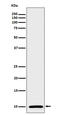 S100 Calcium Binding Protein A1 antibody, M02503-3, Boster Biological Technology, Western Blot image 