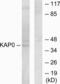 cAMP-dependent protein kinase type I-alpha regulatory subunit antibody, LS-C118775, Lifespan Biosciences, Western Blot image 