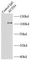 ACTN4 antibody, FNab00123, FineTest, Immunoprecipitation image 