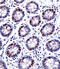 Deoxyuridine 5 -triphosphate nucleotidohydrolase, mitochondrial antibody, abx027875, Abbexa, Immunohistochemistry paraffin image 