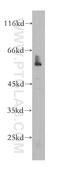 Nuclear Receptor Subfamily 1 Group H Member 3 antibody, 60134-1-Ig, Proteintech Group, Western Blot image 