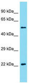 Akirin 2 antibody, TA331307, Origene, Western Blot image 