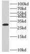 MAGI Family Member, X-Linked antibody, FNab04953, FineTest, Western Blot image 