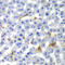 Small heterodimer partner antibody, LS-C331719, Lifespan Biosciences, Immunohistochemistry paraffin image 
