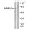 Matrix Metallopeptidase 2 antibody, SPC-1278D-ALP, StressMarq, Western Blot image 