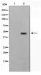 Zinc Finger Protein 174 antibody, TA347710, Origene, Western Blot image 