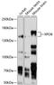 Ranbp20 antibody, 13-629, ProSci, Western Blot image 
