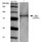 ADAM Metallopeptidase Domain 22 antibody, SMC-411D-HRP, StressMarq, Western Blot image 