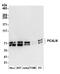 Phosphatidylinositol-binding clathrin assembly protein antibody, A305-301A, Bethyl Labs, Western Blot image 
