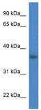 Gal-4 antibody, TA346427, Origene, Western Blot image 