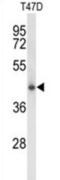 Ceroid-lipofuscinosis neuronal protein 5 antibody, abx034156, Abbexa, Western Blot image 